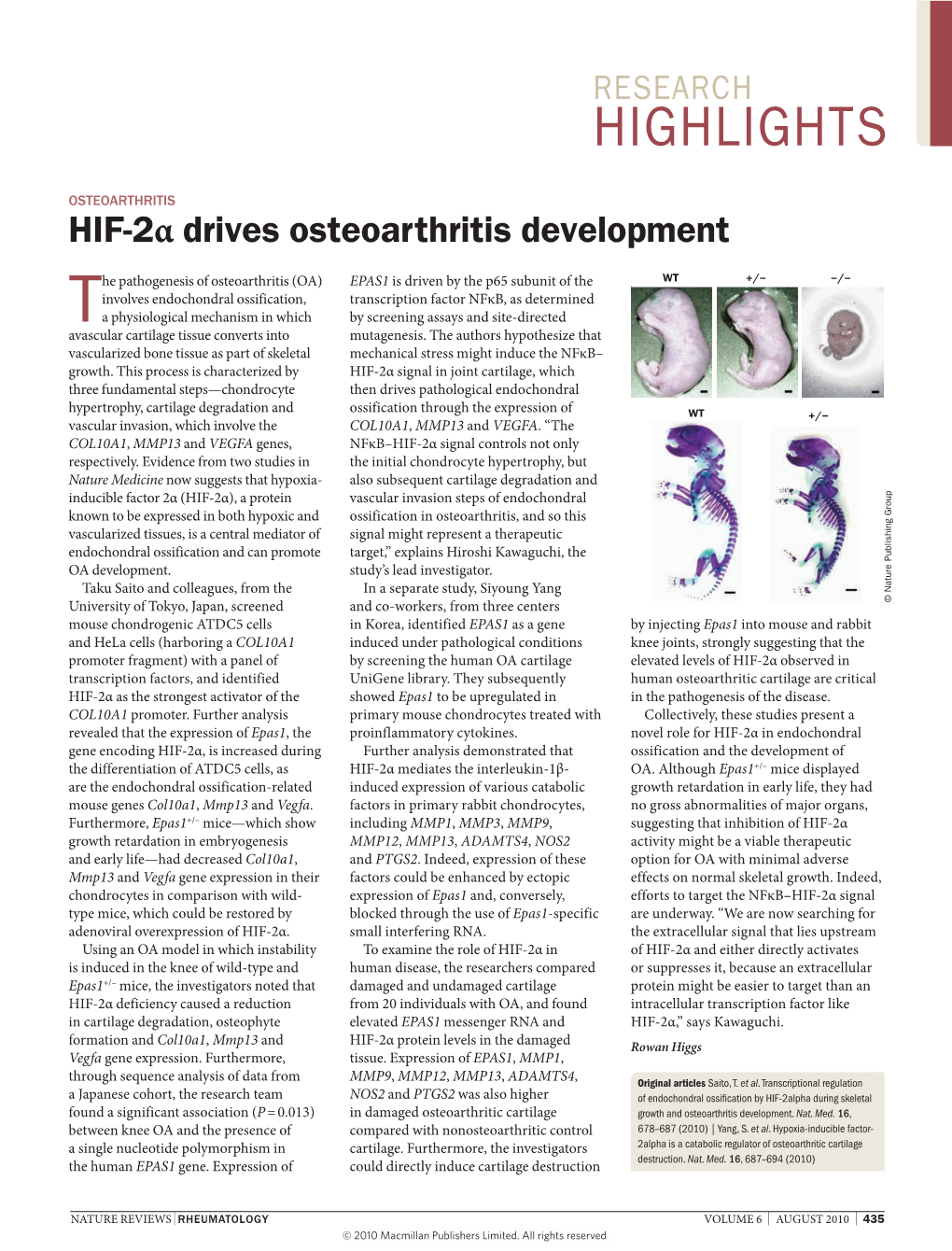 HIF-2Α Drives Osteoarthritis Development