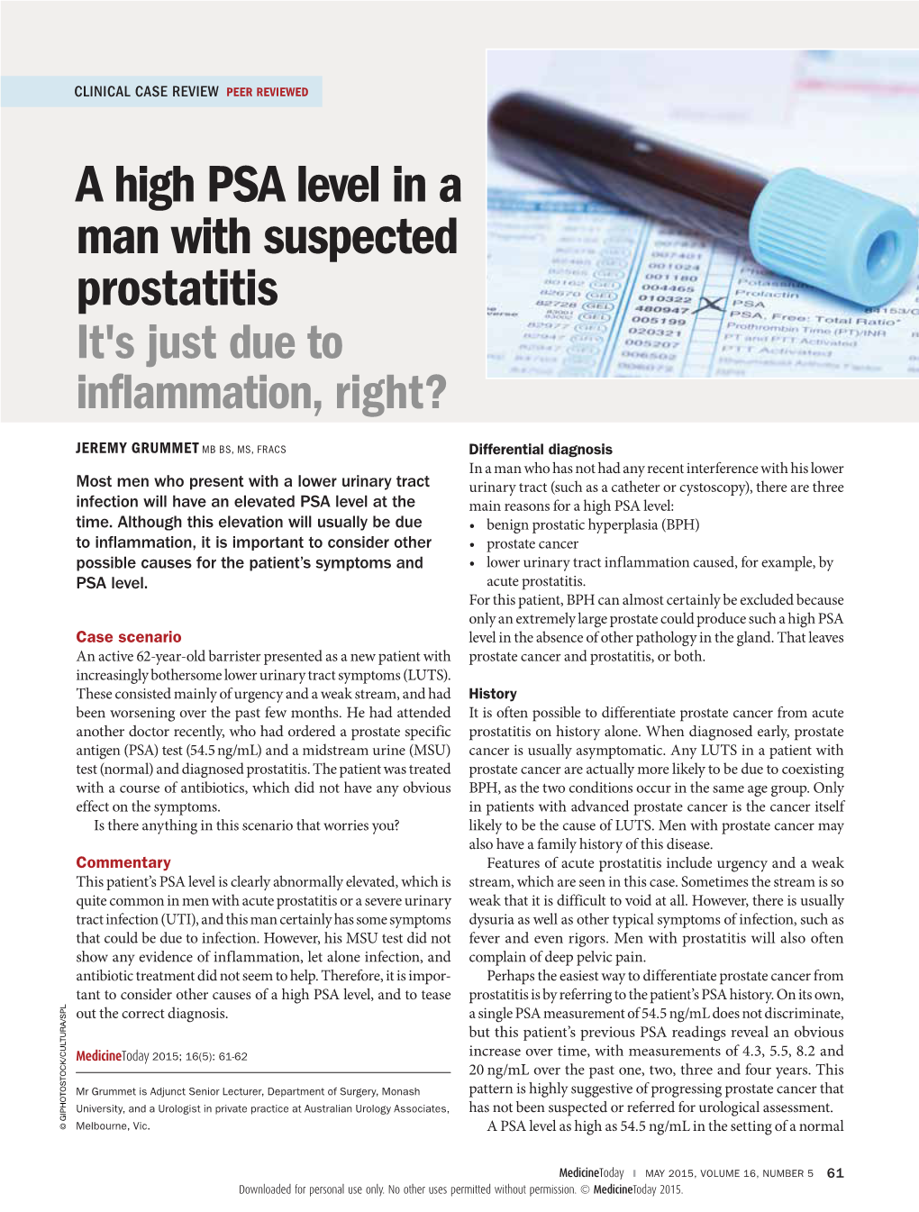 A High PSA Level in a Man Awith Suspected Prostatitis. It's Just Due To