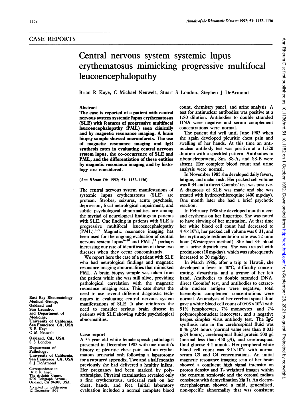 Central Nervous System Systemic Lupus Erythematosus Mimicking Progressive Multifocal Leucoencephalopathy