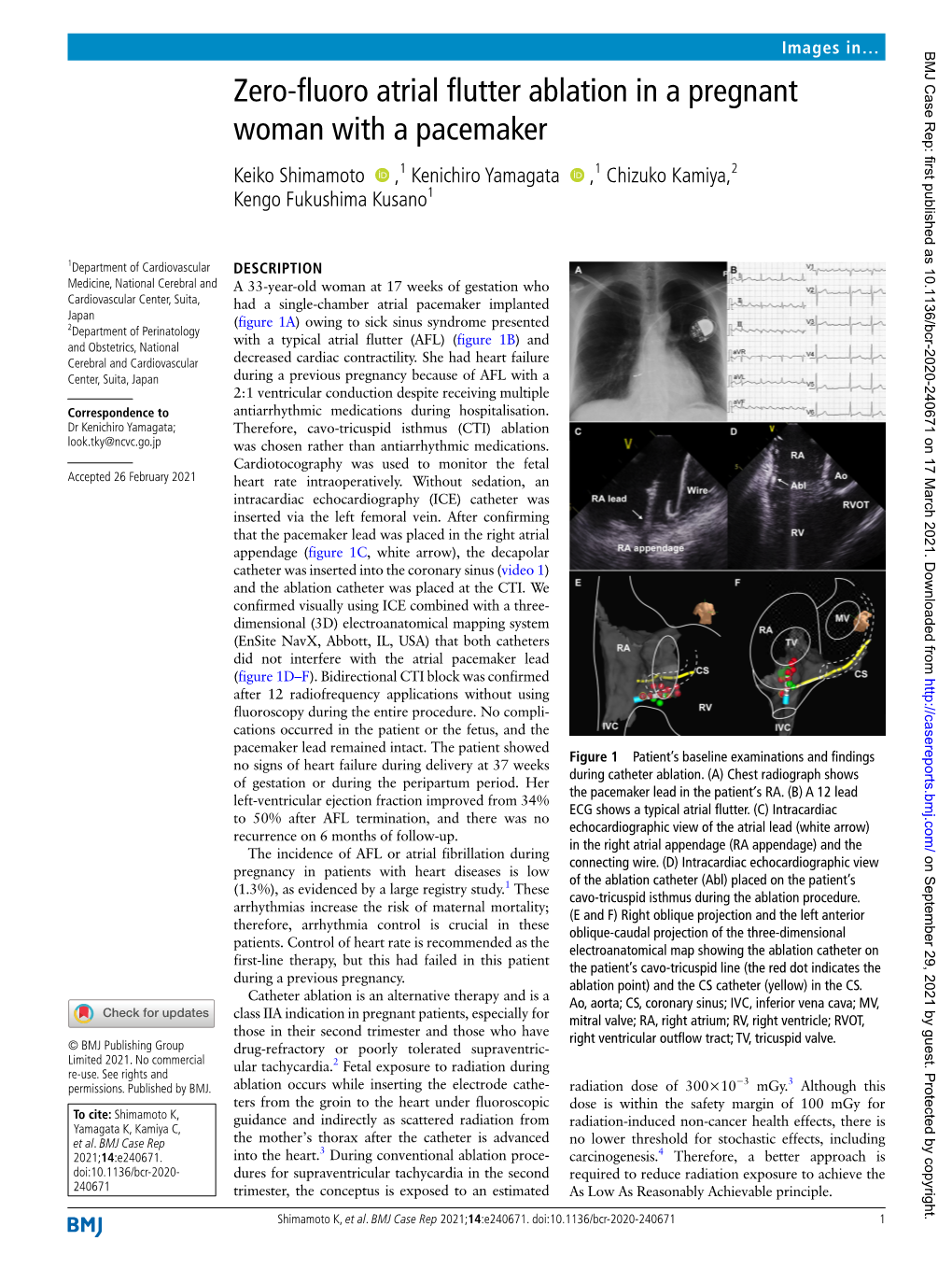 Zero-Fluoro Atrial Flutter Ablation in a Pregnant Woman with a Pacemaker