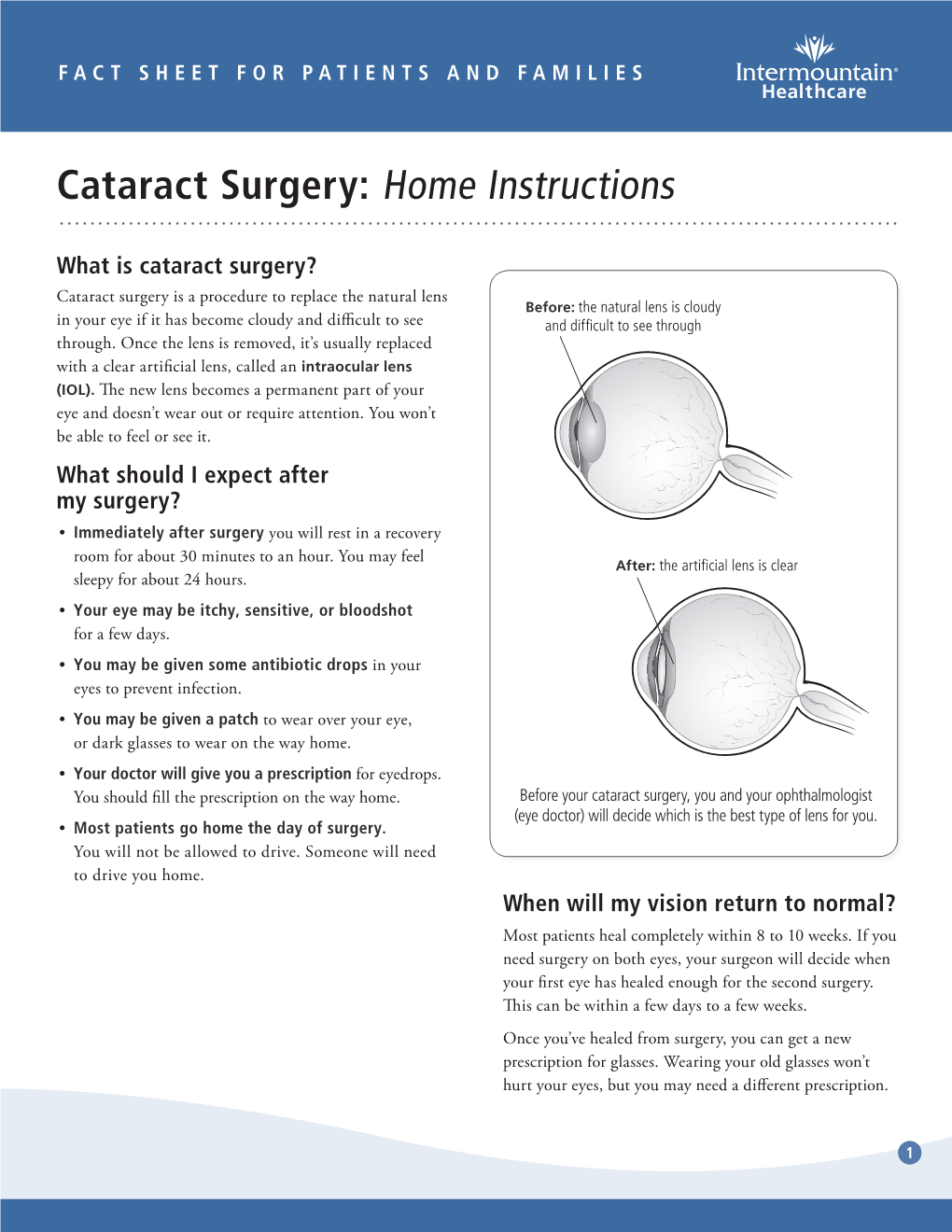 Cataract Surgery: Home Instructions