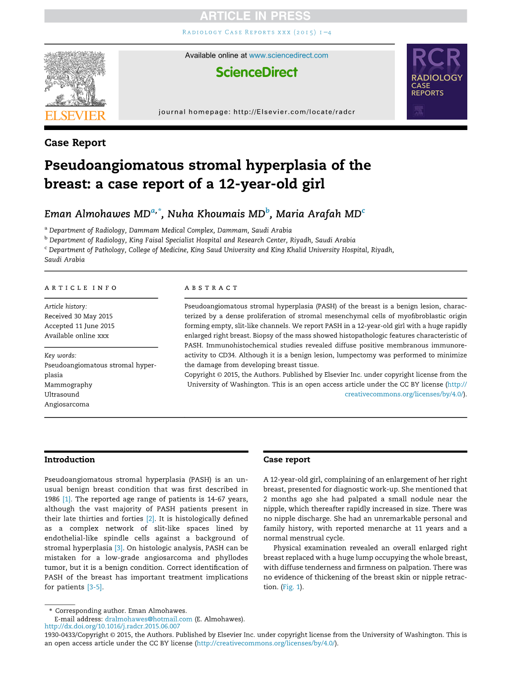 Pseudoangiomatous Stromal Hyperplasia of the Breast: a Case Report of a 12-Year-Old Girl