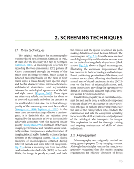 2. Screening Techniques