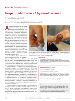Herpetic Whitlow in a 39-Year-Old Woman