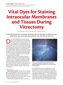 Vital Dyes for Staining Intraocular Membranes and Tissues During Vitrectomy an Overview of Vital Dyes and Their Characteristics