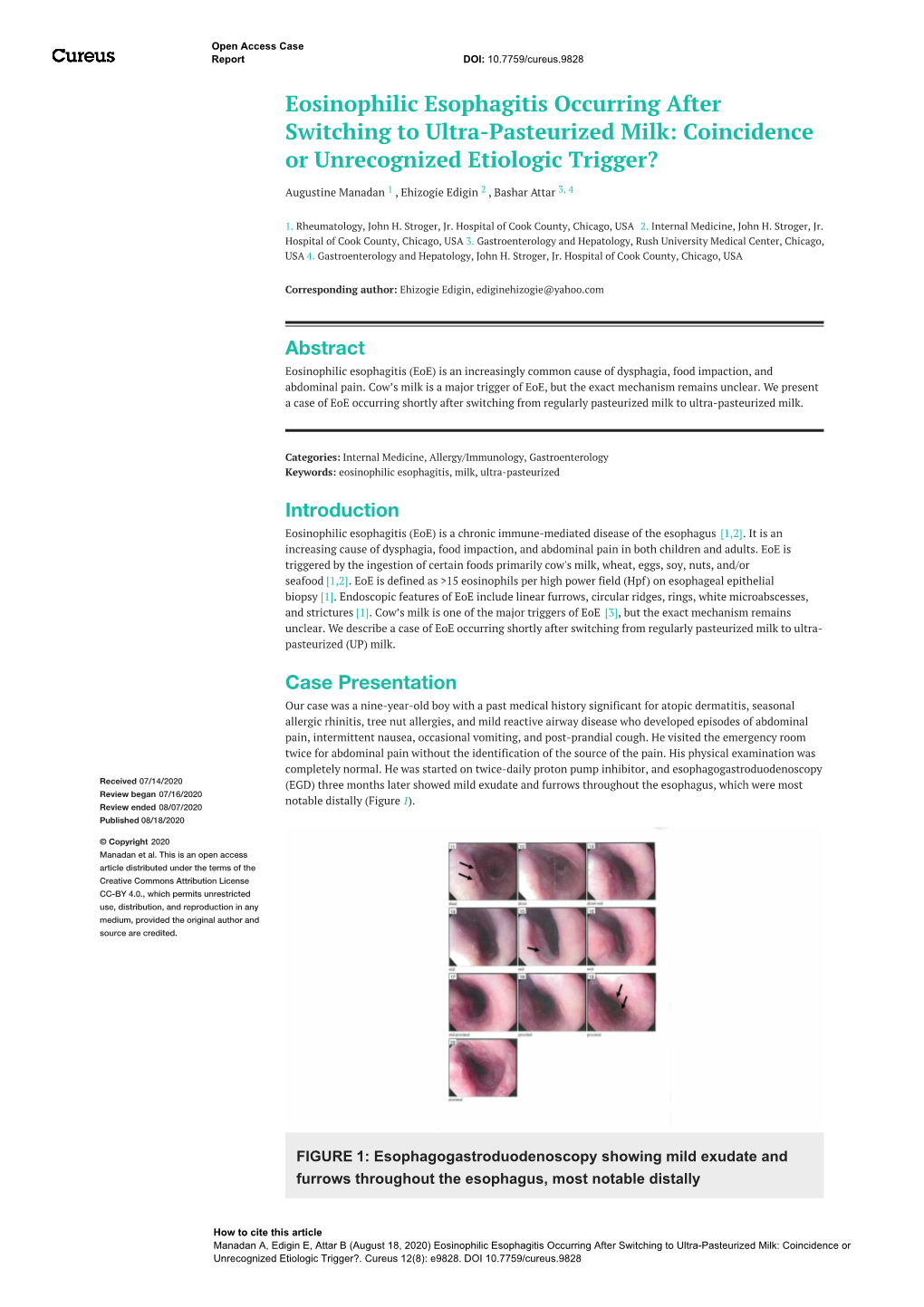 Eosinophilic Esophagitis Occurring After Switching to Ultra-Pasteurized Milk: Coincidence Or Unrecognized Etiologic Trigger?