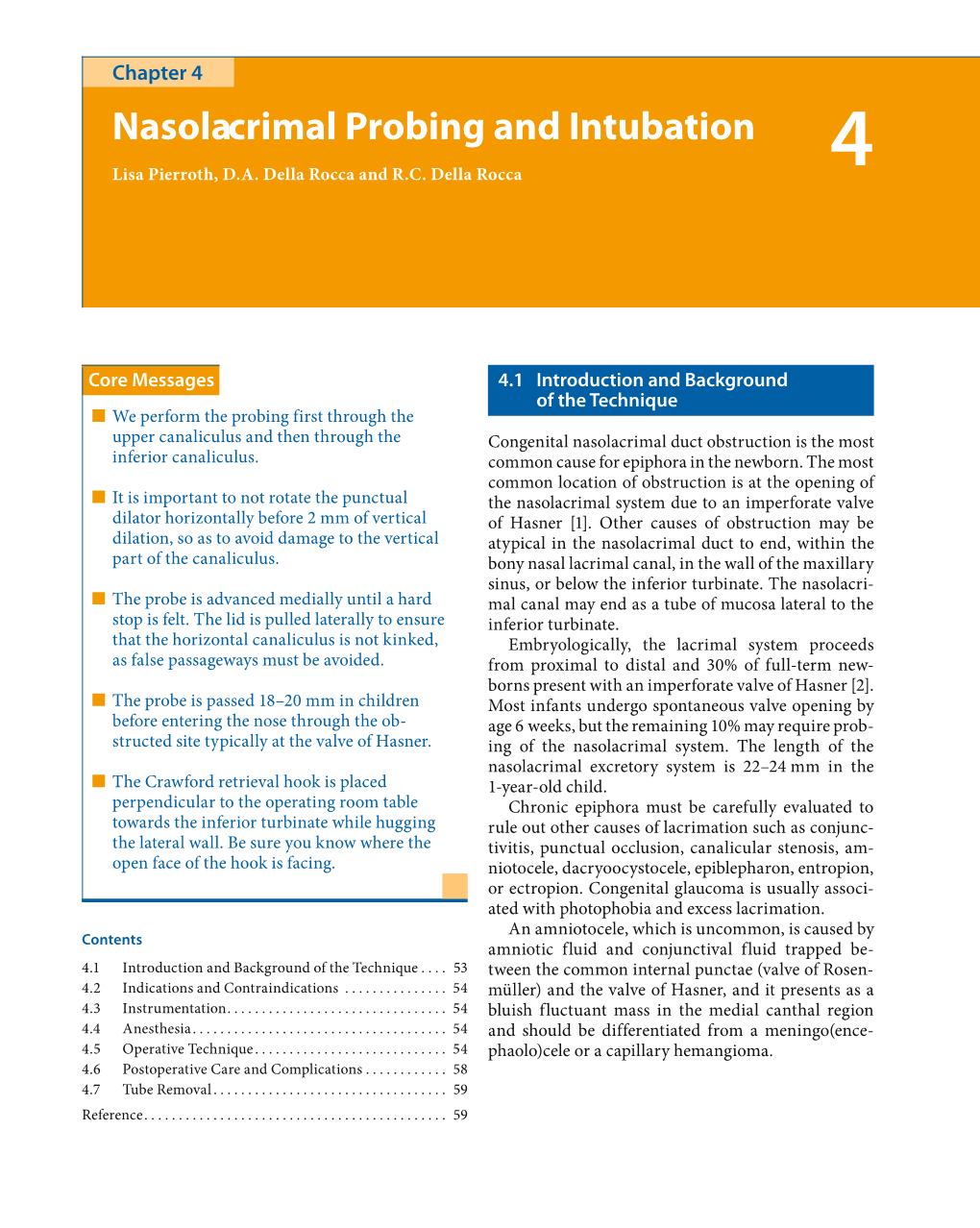 Nasolacrimal Probing and Intubation Chapter 4 53 Nasolacrimal Probing and Intubation 4 Lisa Pierroth, D.A