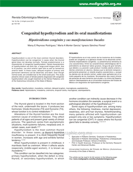 Congenital Hypothyrodism and Its Oral Manifestations Hipotiroidismo Congénito Y Sus Manifestaciones Bucales