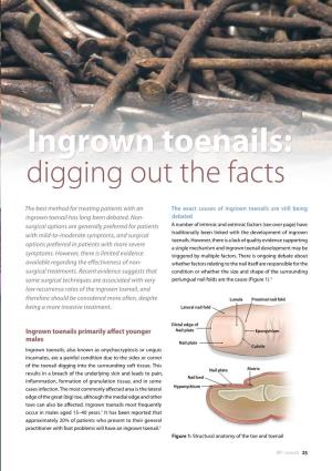 Ingrown Toenails: Digging out the Facts