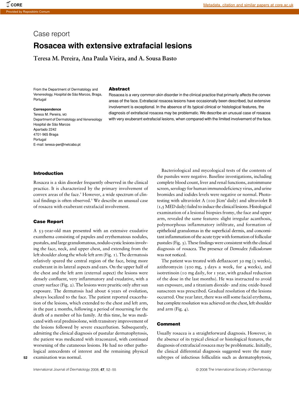 Rosacea with Extensive Extrafacial Lesions Teresa M