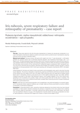 Iris Rubeosis, Severe Respiratory Failure and Retinopathy of Prematurity – Case Report