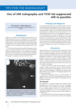 Use of MR Sialography and T2W Fat-Suppressed MR in Parotitis