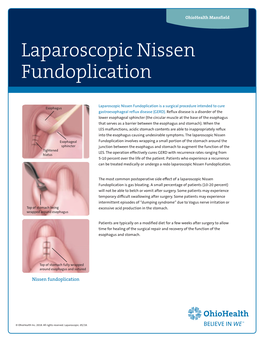 Laparoscopic Nissen Fundoplication Description