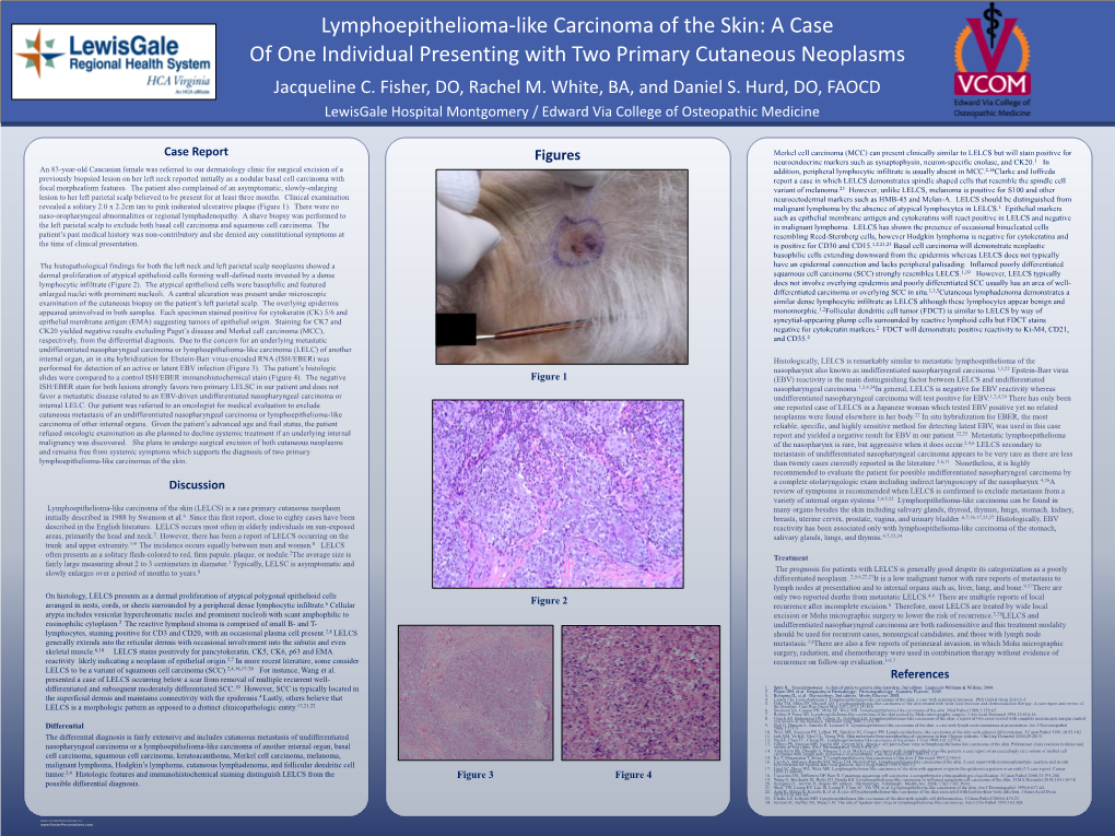 Lymphoepithelioma-Like Carcinoma of the Skin: a Case (--THIS SECTION DOES NOT PRINT--)