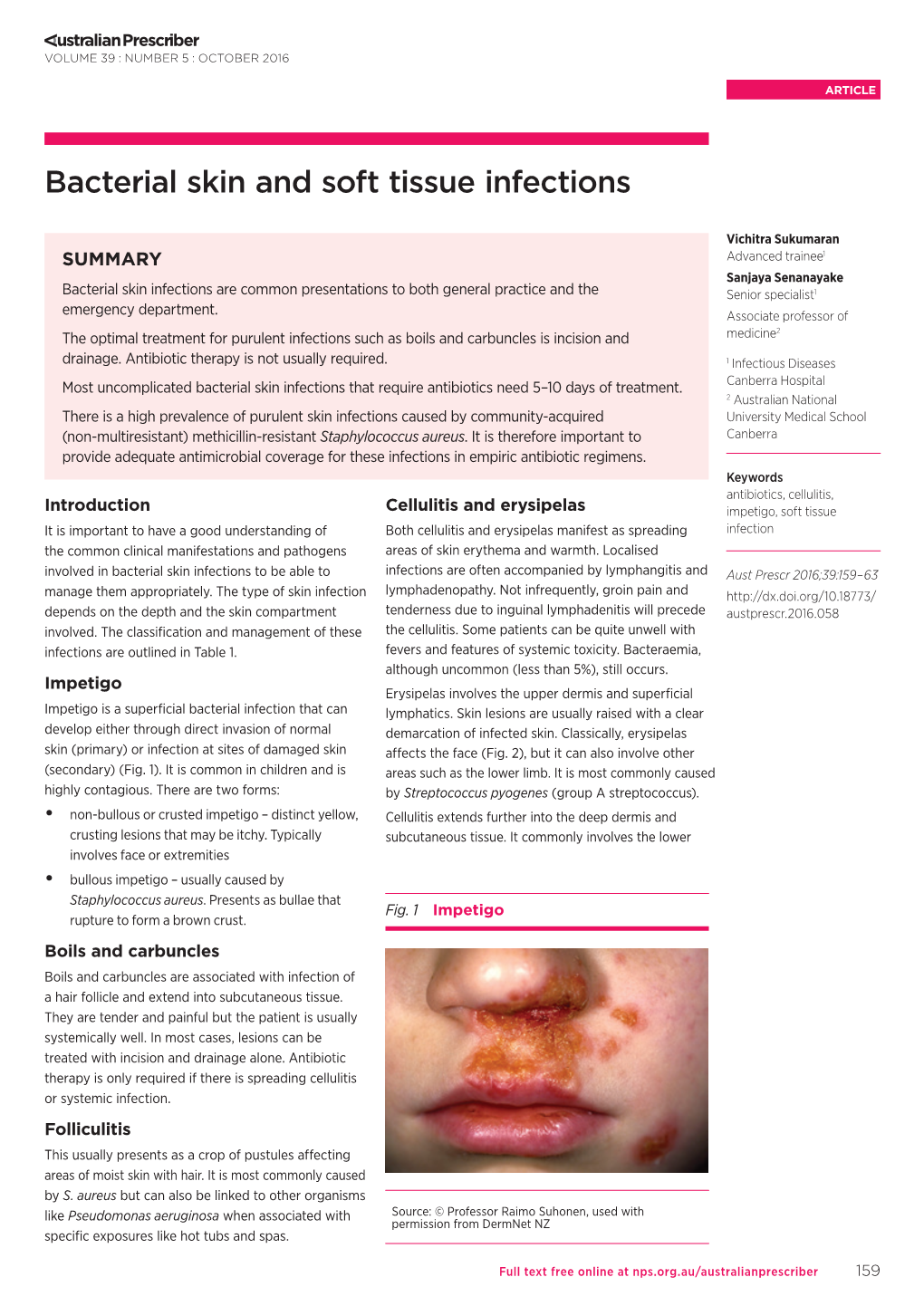 Bacterial Skin and Soft Tissue Infections