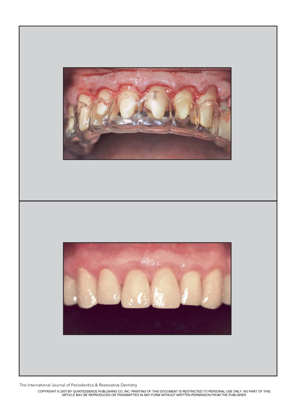 The International Journal of Periodontics & Restorative Dentistry