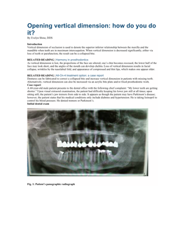 Opening Vertical Dimension: How Do You Do It? by Evelyn Shine, DDS