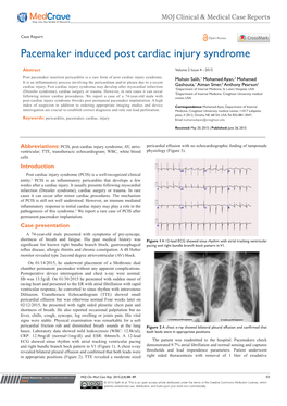 Pacemaker Induced Post Cardiac Injury Syndrome