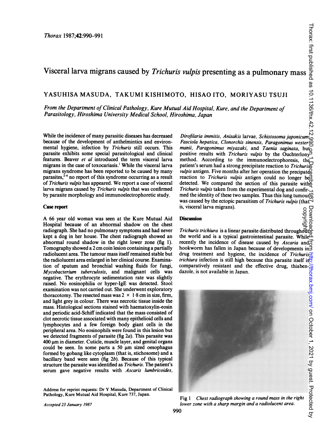 Visceral Larva Migrans Causedby Trichuris Vulpis Presenting As A