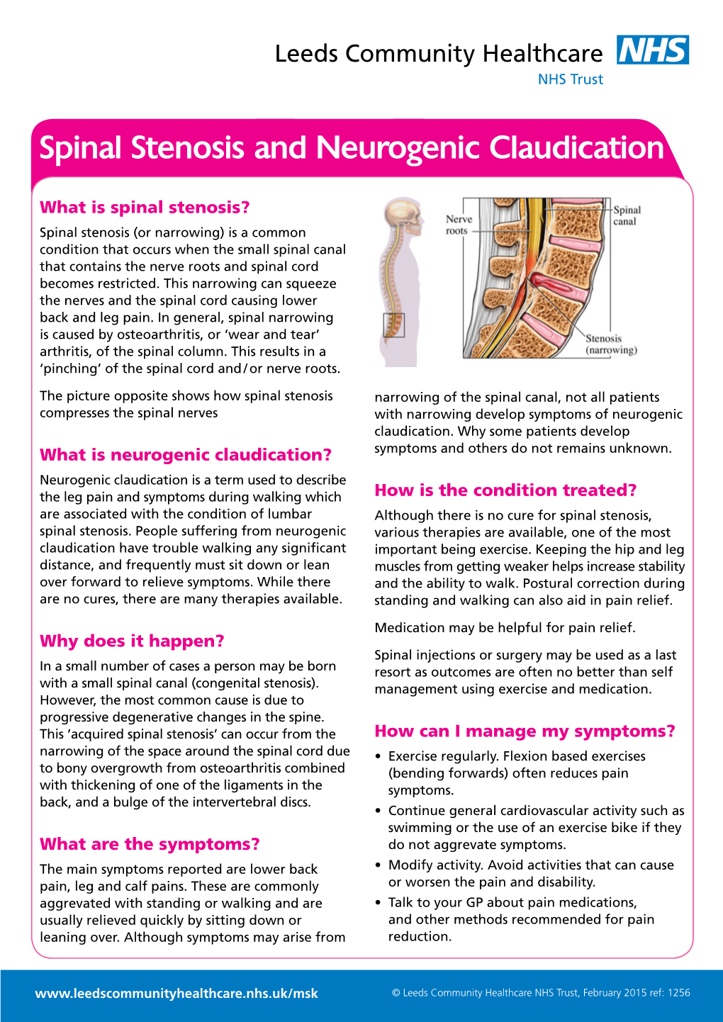 Spinal Stenosis and Neurogenic Claudication