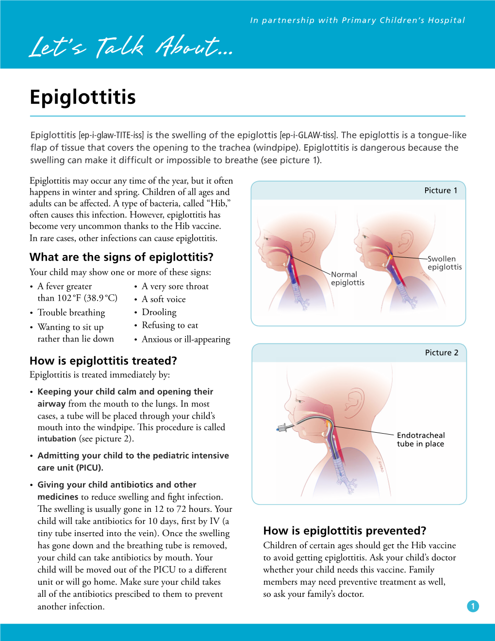 Epiglottitis