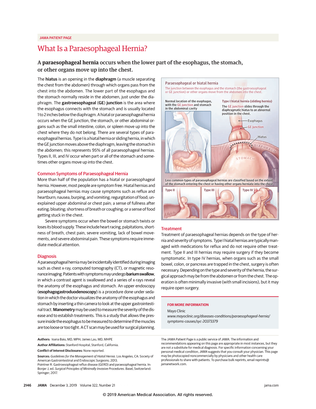 What Is a Paraesophageal Hernia?