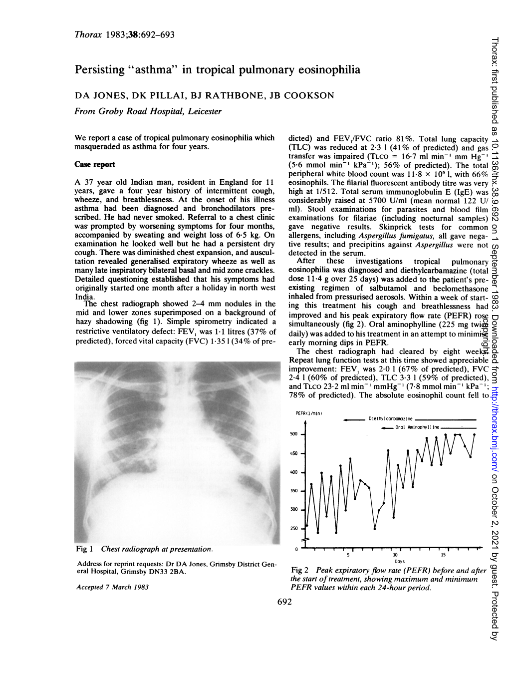 "Asthma" in Tropical Pulmonary Eosinophilia