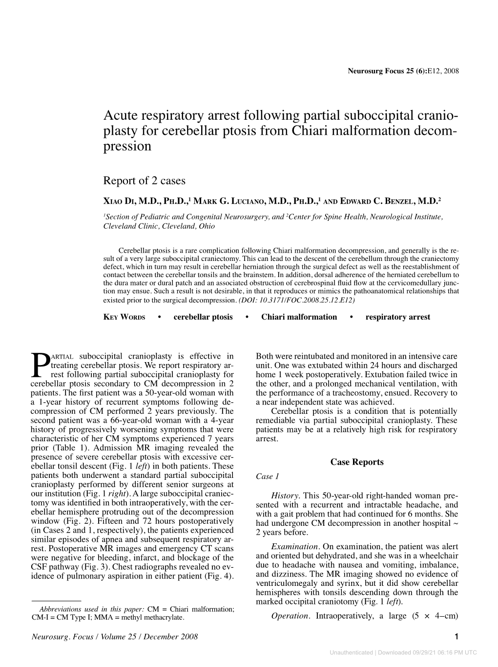 Acute Respiratory Arrest Following Partial Suboccipital Cranio- Plasty for Cerebellar Ptosis from Chiari Malformation Decom- Pression