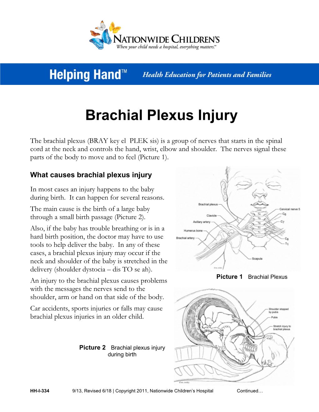 Brachial Plexus Injury