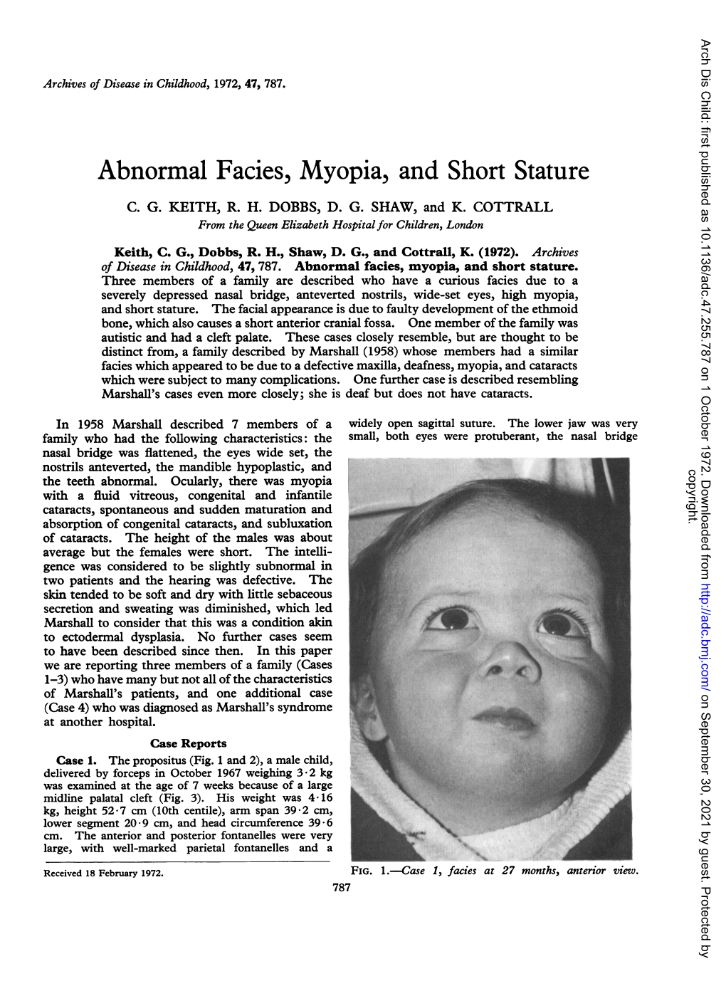 Abnormal Facies, Myopia, Andshort Stature