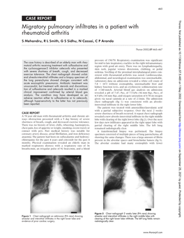 Migratory Pulmonary Infiltrates in a Patient with Rheumatoid Arthritis S Mehandru, R L Smith, G S Sidhu, N Cassai, C P Aranda