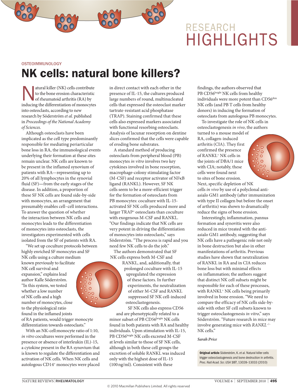 NK Cells: Natural Bone Killers?