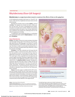 Rhytidectomy (Face-Lift Surgery)