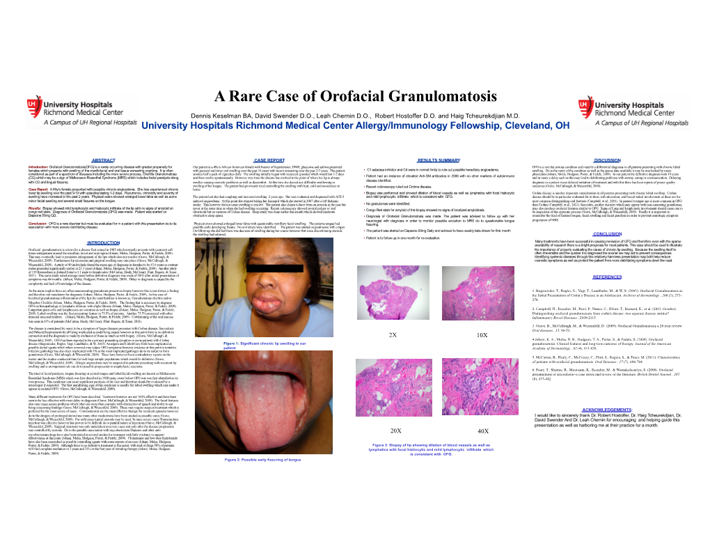 A Rare Case of Orofacial Granulomatosis