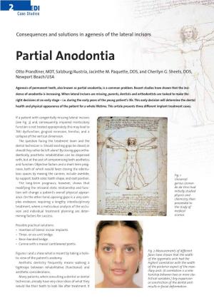 Partial Anodontia