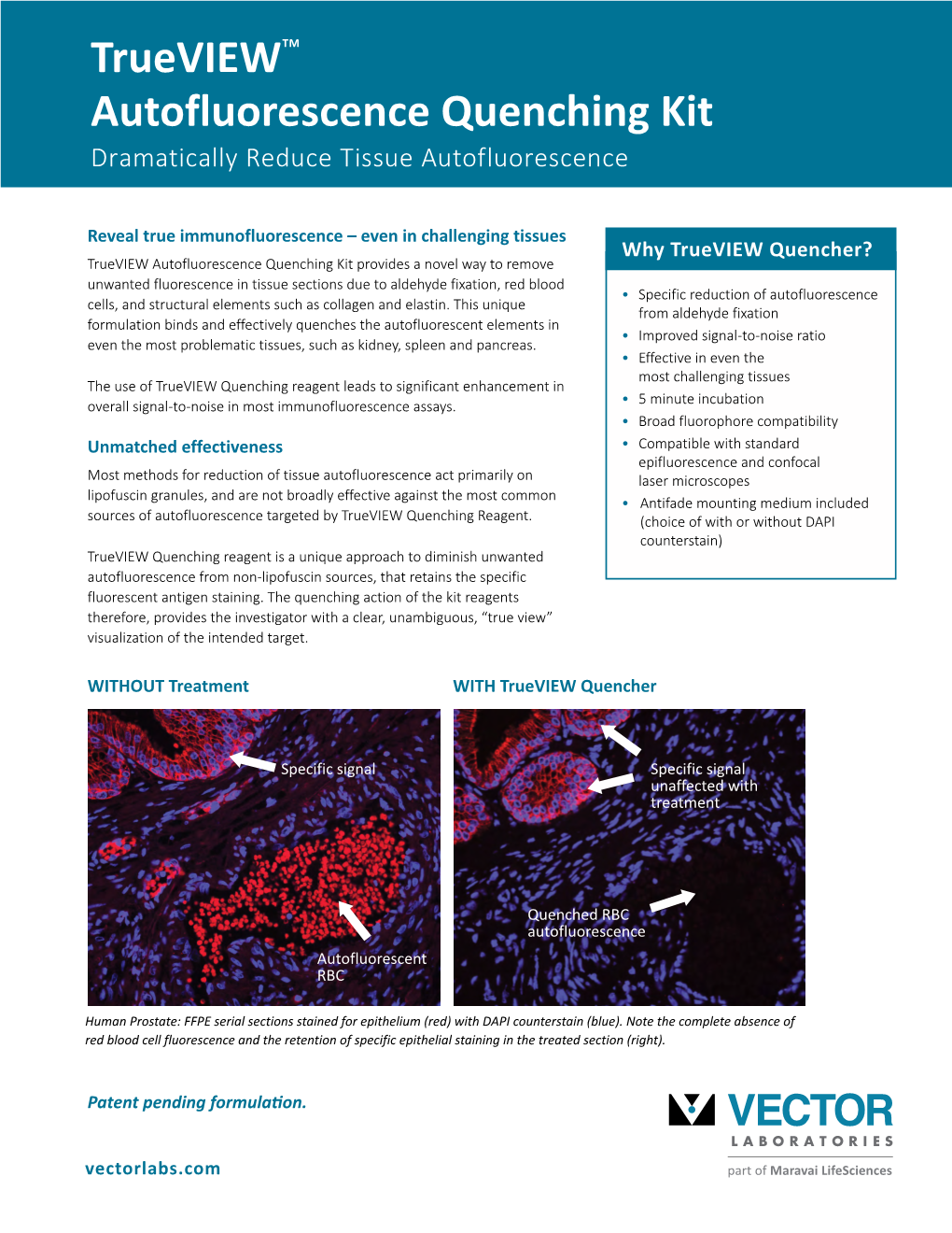 Trueview™ Autofluorescence Quenching Kit Dramatically Reduce Tissue Autofluorescence