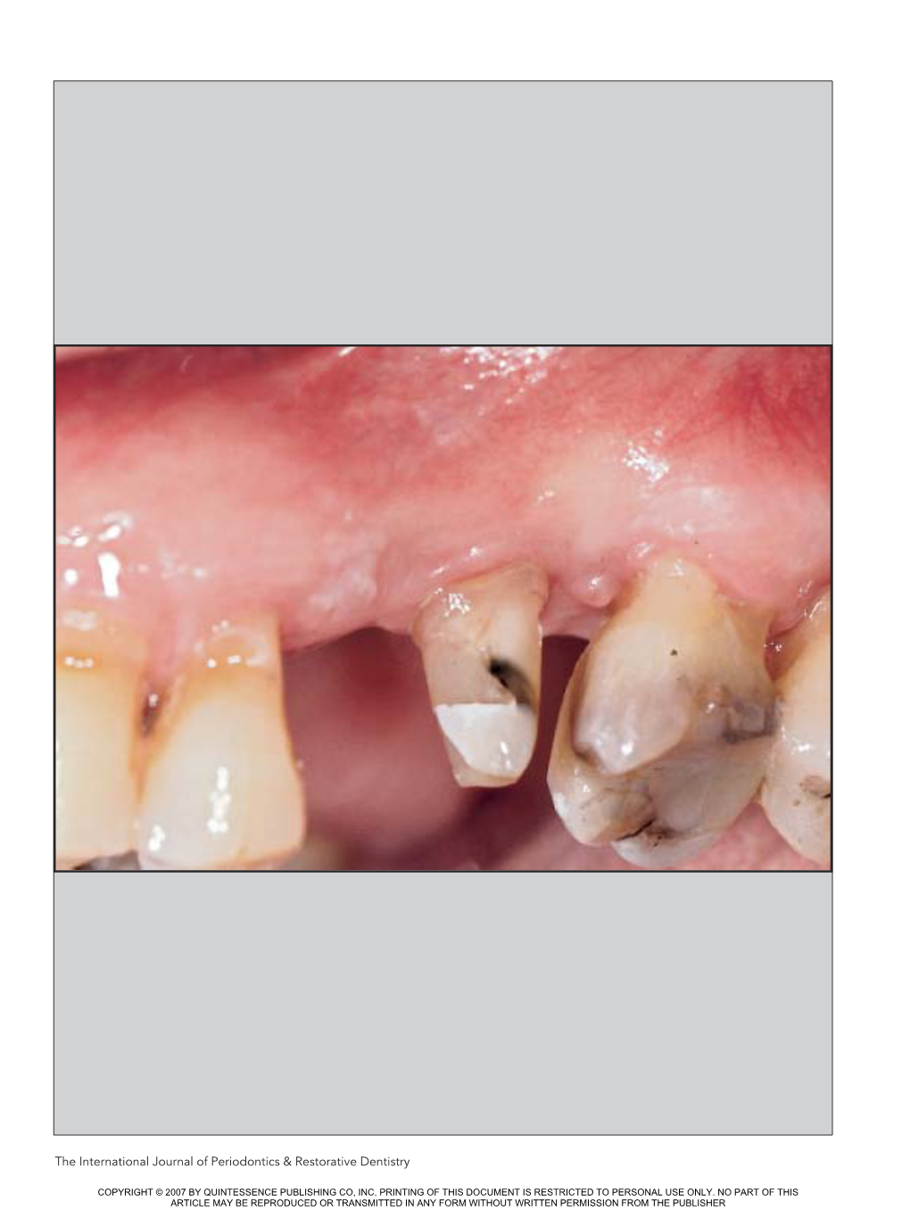 The International Journal of Periodontics & Restorative Dentistry