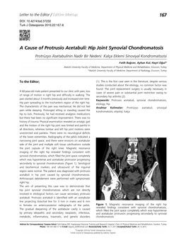 A Cause of Protrusio Acetabuli: Hip Joint Synovial Chondromatosis Protrüzyo Asetabulinin Nadir Bir Nedeni: Kalça Eklemi Sinoviyal Kondromatozisi