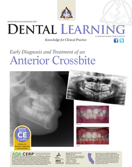 Early Diagnosis and Treatment of an Anterior Crossbite