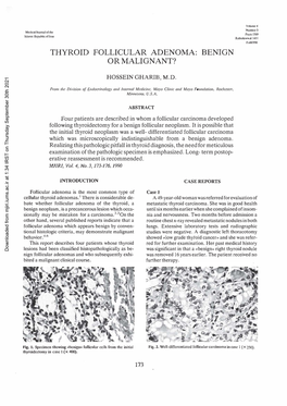 Thyroid Follicular Adenoma: Benign Or Malignant?