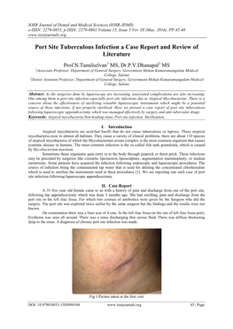 Port Site Tuberculous Infection a Case Report and Review of Literature