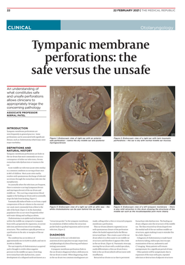 Tympanic Membrane Perforations: the Safe Versus the Unsafe