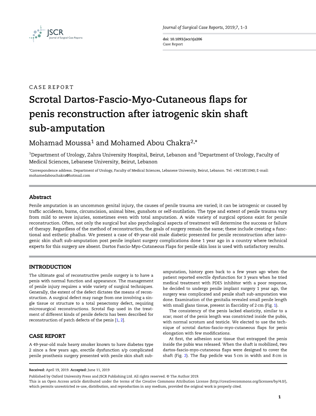 Scrotal Dartos-Fascio-Myo-Cutaneous Flaps for Penis Reconstruction After Iatrogenic Skin Shaft Sub-Amputation