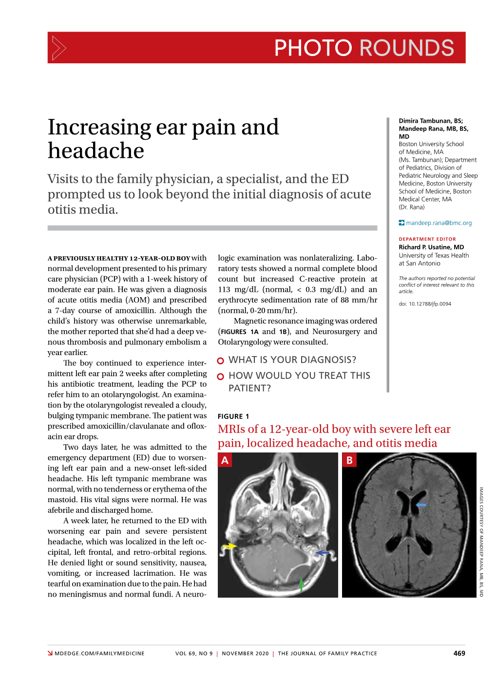 Increasing Ear Pain and Headache