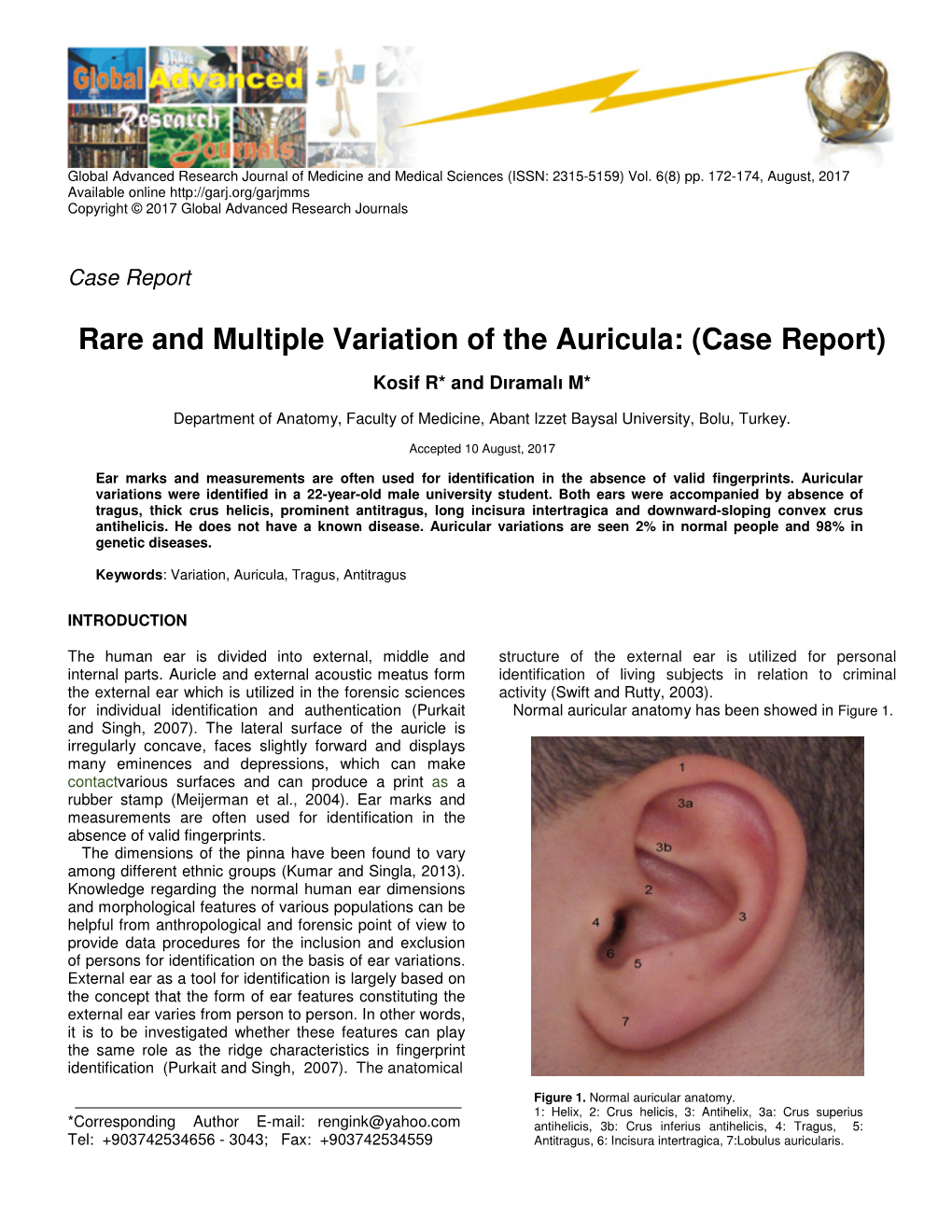 Rare and Multiple Variation of the Auricula: (Case Report)