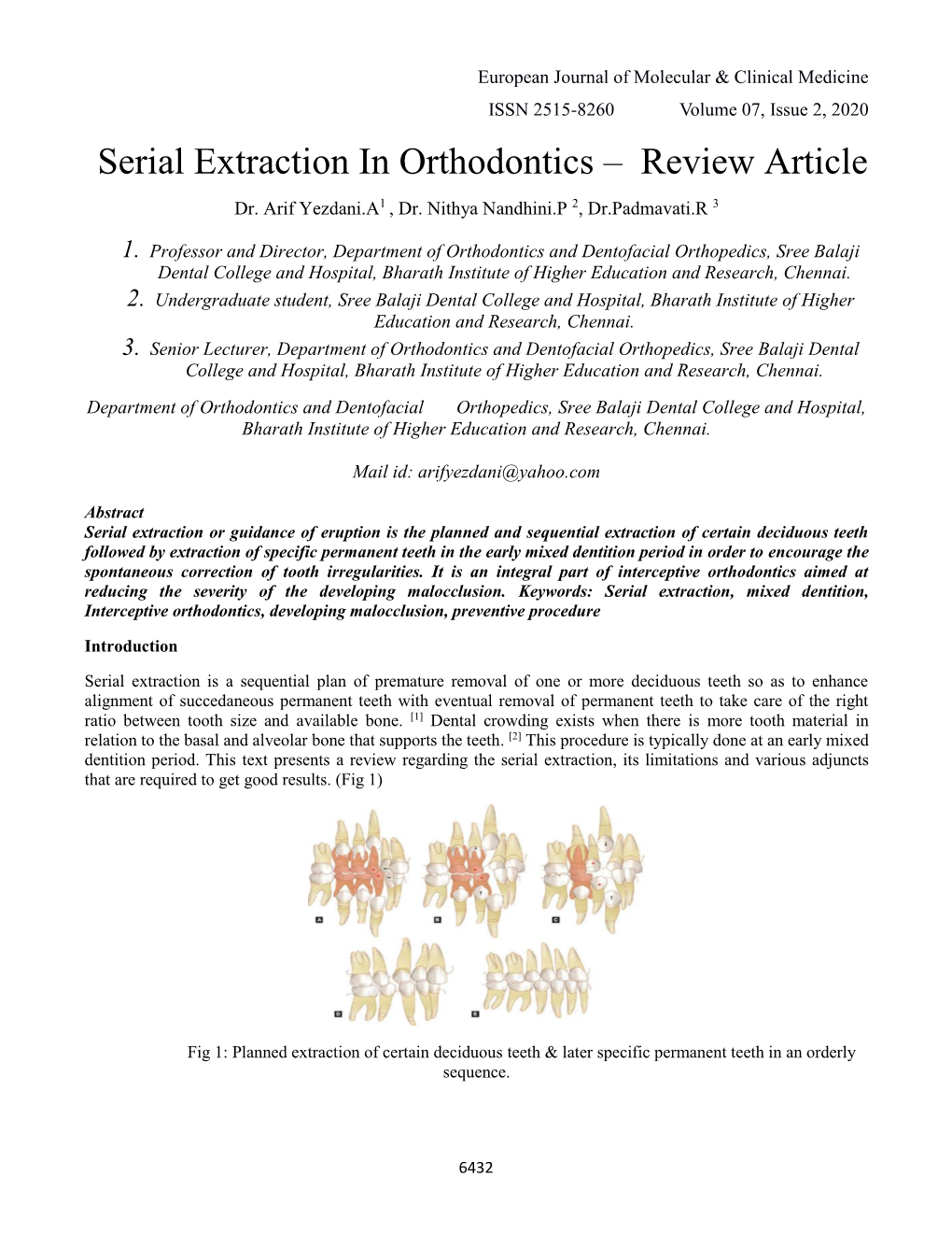 Serial Extraction in Orthodontics – Review Article Dr