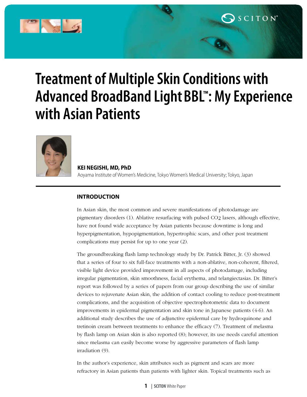 Treatment of Multiple Skin Conditions with Advanced Broadband Lightbbl