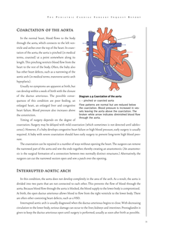 Coarctation of the Aorta Interrupted Aortic Arch