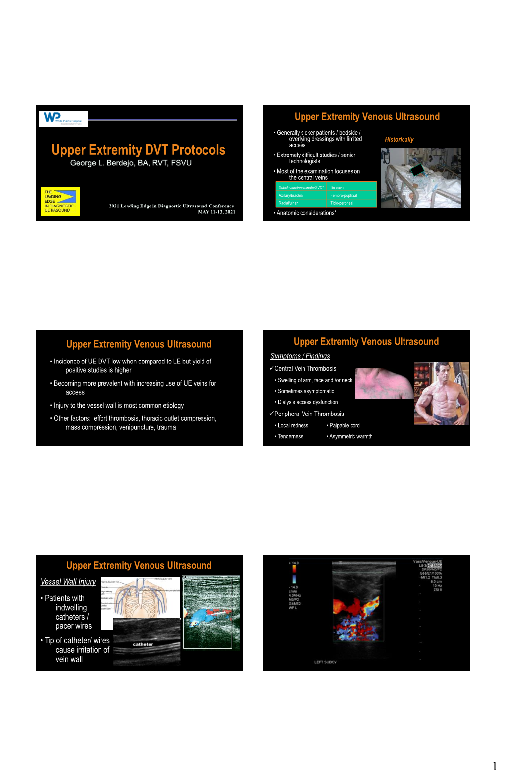 Upper Extremity Venous Ultrasound