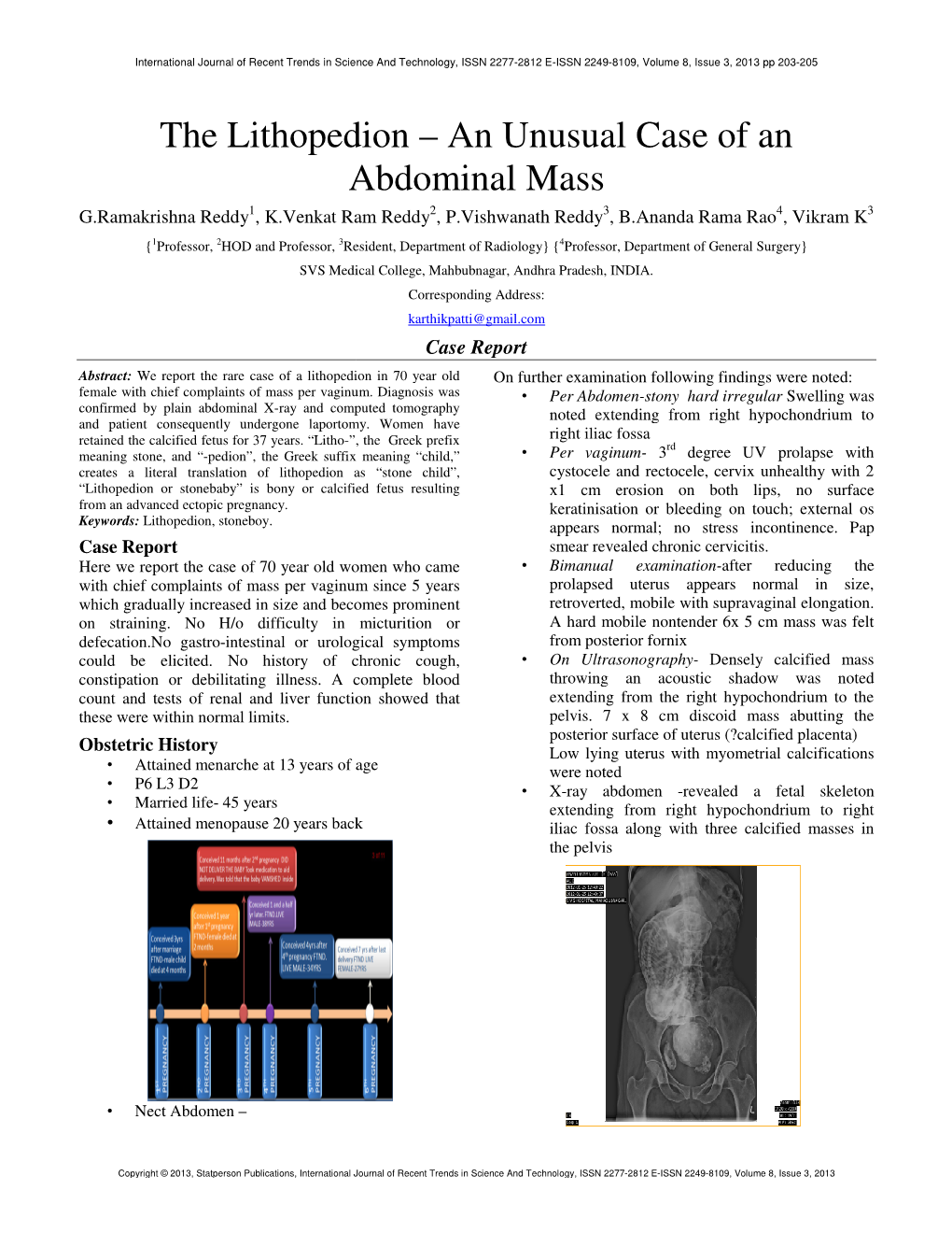 An Unusual Case of an Abdominal Mass Nusual Case of An